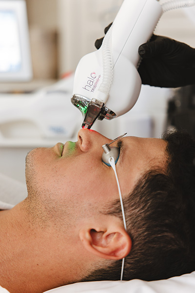 Sciton Halo Tribrid Laser Skin Resurfacing in Raleigh NC