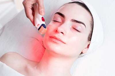 Vivace Ultra RF Microneedling Raleigh NC