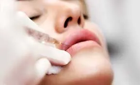 Dermal Filler Lip Injections in Raleigh NC