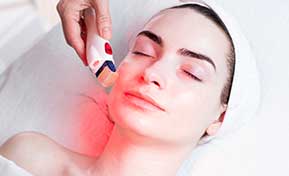 Vivace Microneedling Raleigh NC